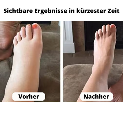 ORT® Kompressionsstrümpfe
